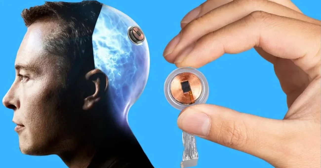 The FDA approved Elon Musk's Neuralink to begin human trials of the tiny brain implant, which is controlled via Bluetooth from a phone.